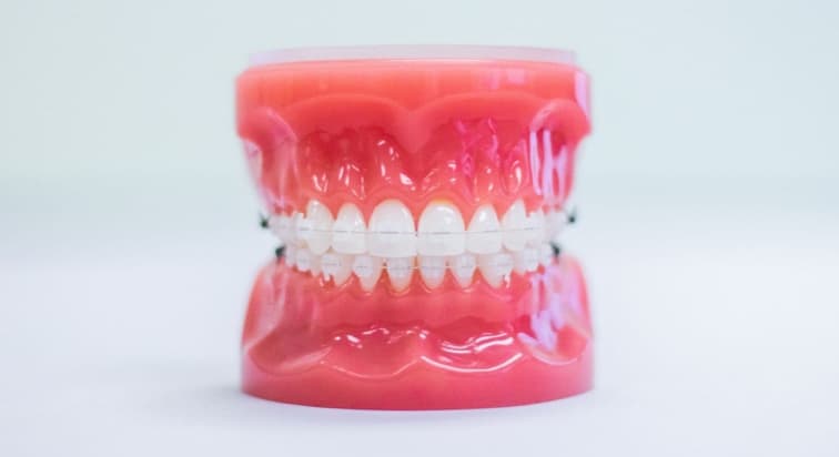 Clear Braces image